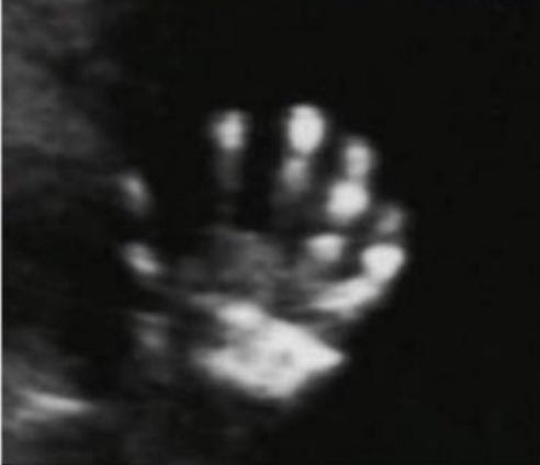 Happy parents at Tummy Time