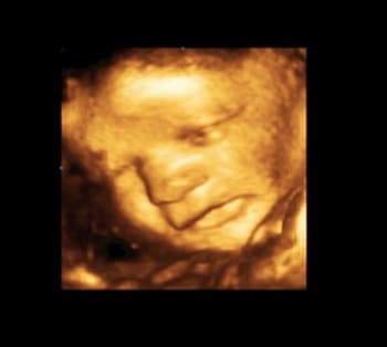 Tummy Time experience