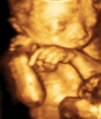 4D baby face ultrasound