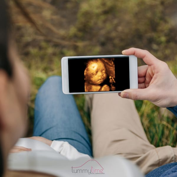 4D ultrasound scan of baby