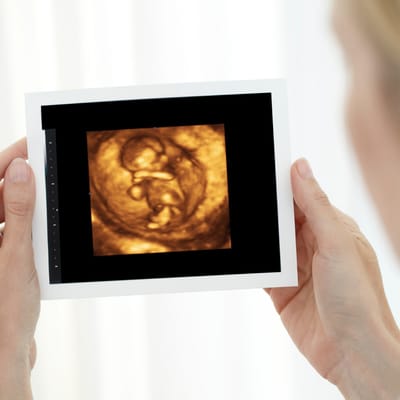 3D baby scan